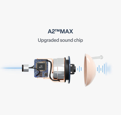 🔥 Today Only! DarkFairy™ Atom X Smart Hearing Aids — Hear Clearly, Feel Confident Again 💖